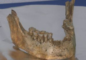 Mandíbula calcolítica de Santimamiñe (4.000 años antes del presente)